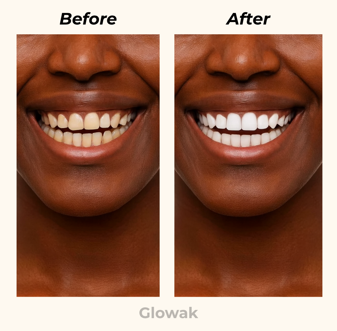Glowak