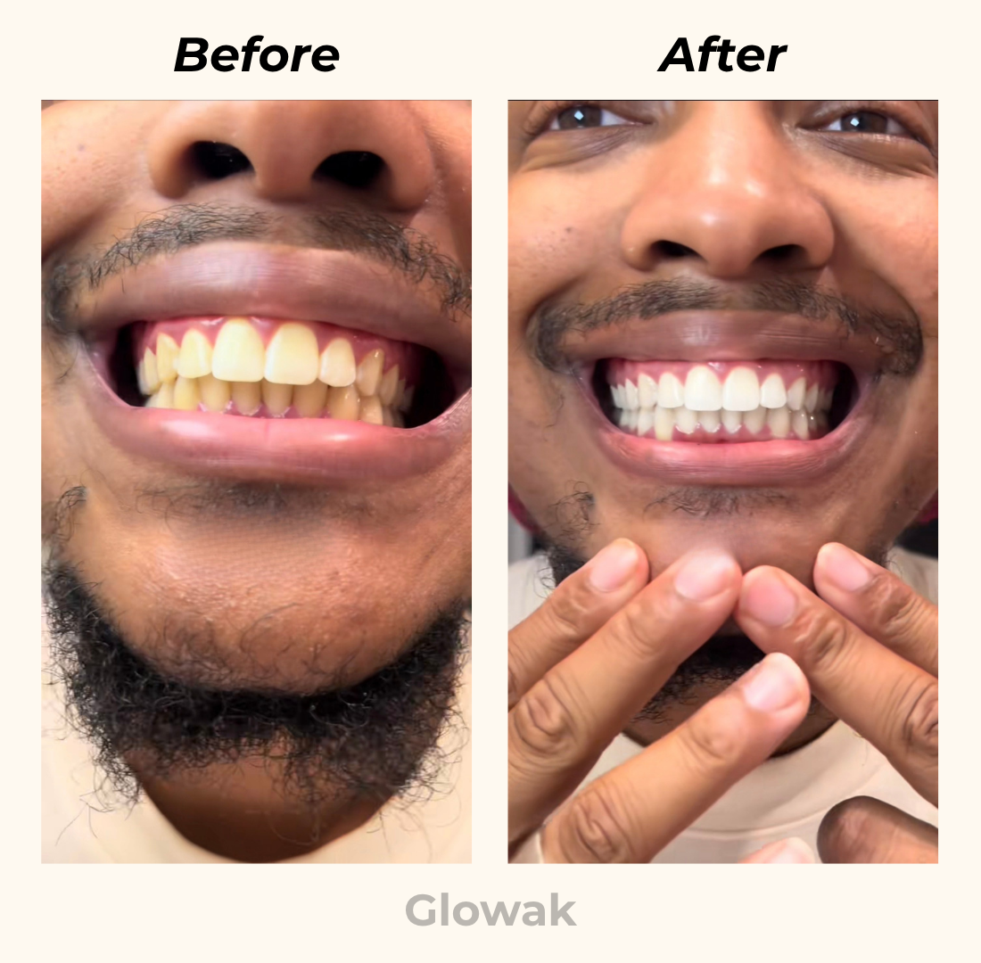 Glowak